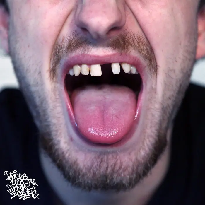 Res & Datkid - Drugs, Booze & Dental Issues