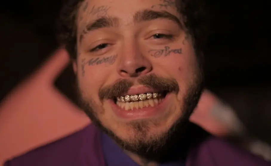 Post Malone Dientes