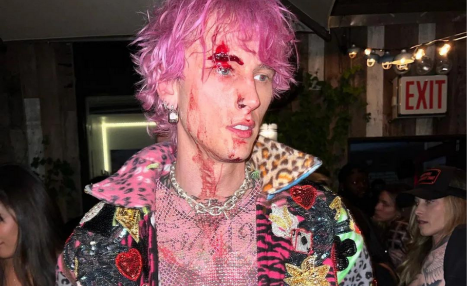 Machine Gun Kelly con la cara llena de sangre