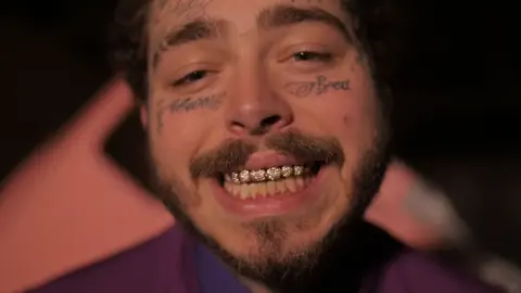 Post Malone Dientes